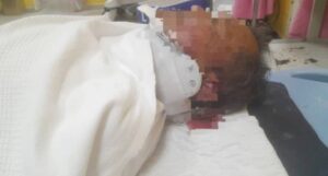 Atuk cedera diserang gajah liar ketika ke surau